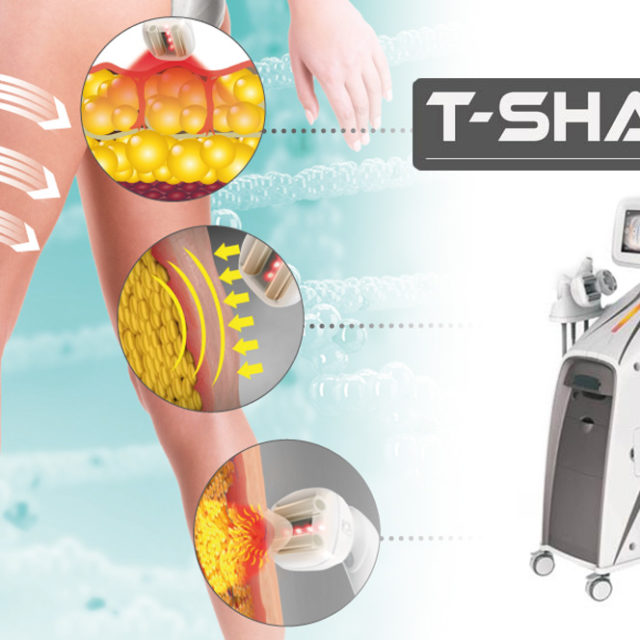 tshape_news-640x640